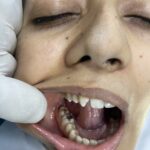 IMG 1011 dentist in varanasi