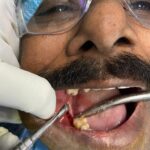 IMG 20211219 WA0033 dentist in varanasi