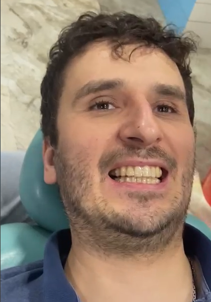 ALigners dentist in varanasi