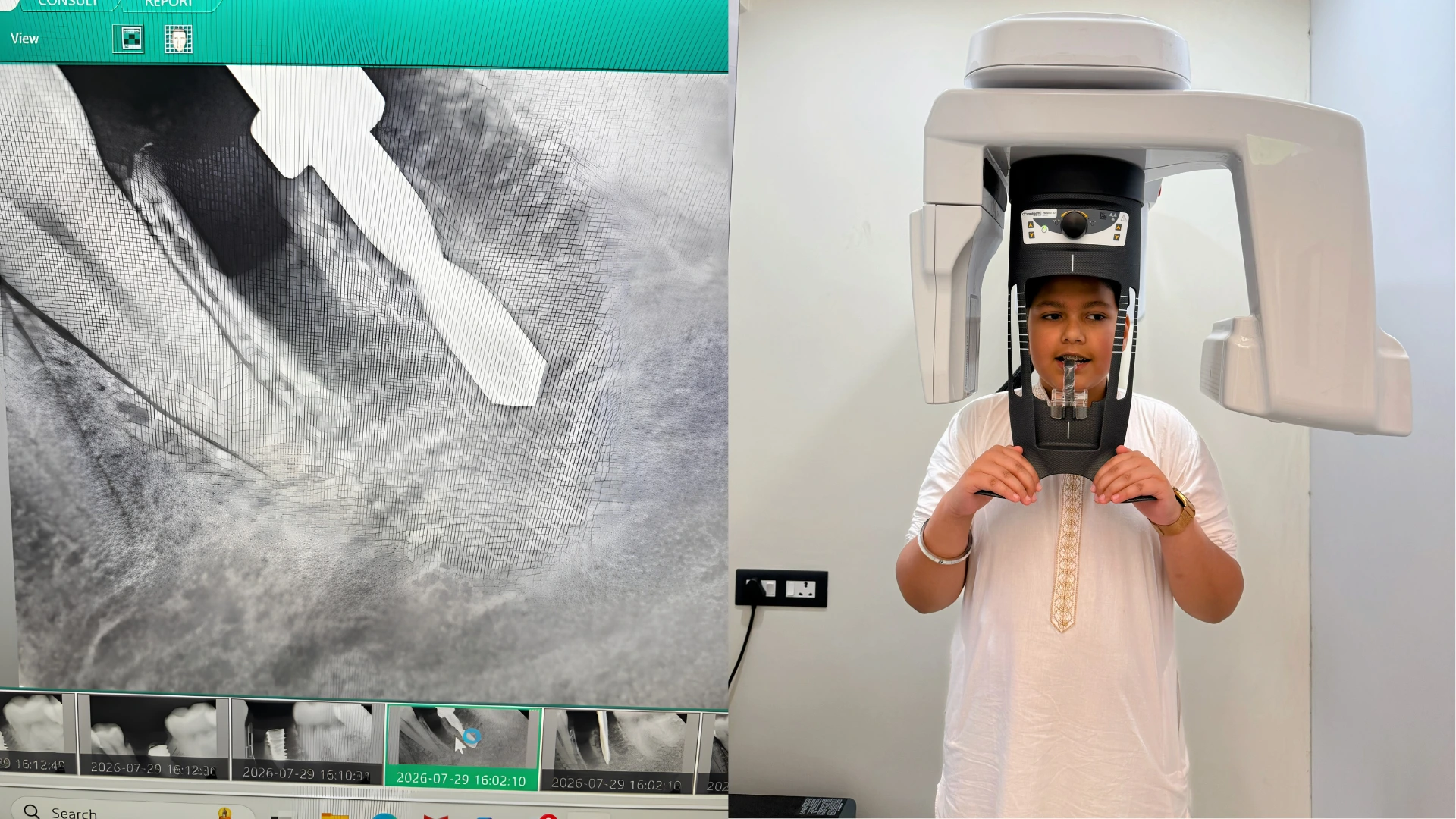 Dental X-Ray, OPG & CBCT Scan at oro dental clinic