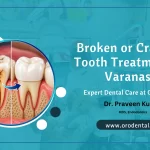 Broken or Cracked Tooth Treatment in Varanasi – Expert Dental Care at Oro Dental