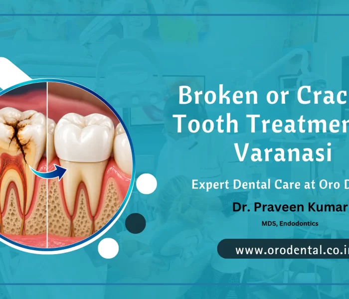 Broken or Cracked Tooth Treatment in Varanasi – Expert Dental Care at Oro Dental